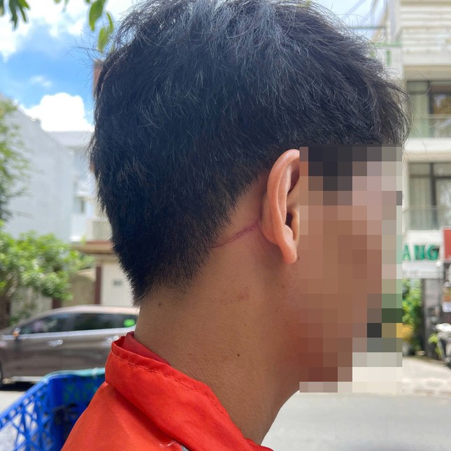 Điều tra vụ nam shipper ở TPHCM bị đánh gãy sống mũi - Ảnh 2. Điều tra vụ nam shipper ở TPHCM bị đánh gãy sống mũi - Ảnh 2.