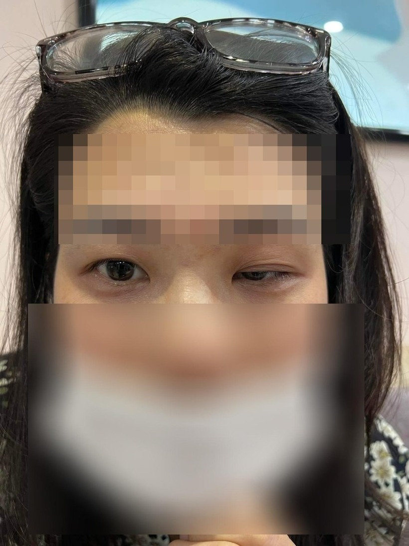 Bi hài hậu vận sau thẩm mỹ: Tiêm botox để thành "hot girl", cô gái nhận cái kết "mặt đơ như tượng" - Ảnh 3. Bi hài hậu vận sau thẩm mỹ: Tiêm botox để thành "hot girl", cô gái nhận cái kết "mặt đơ như tượng" - Ảnh 3.