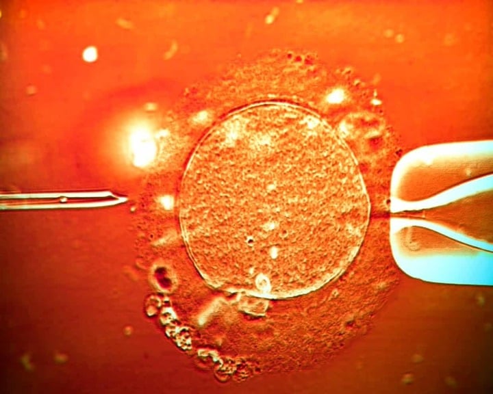 67 trẻ sinh ra từ tinh trùng người hiến mang gene ung thư, 10 trẻ mắc bệnh - Ảnh 2. 67 trẻ sinh ra từ tinh trùng người hiến mang gene ung thư, 10 trẻ mắc bệnh - Ảnh 2.