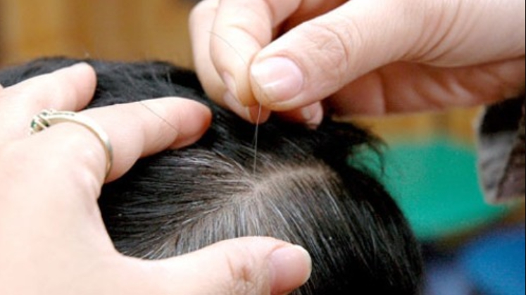 Vừng đen: "Thần dược" giúp tóc bạc hóa đen hay chỉ là lời đồn?- Ảnh 3. Vừng đen: "Thần dược" giúp tóc bạc hóa đen hay chỉ là lời đồn?- Ảnh 3.
