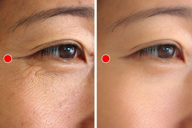 Bóc trần 4 lầm tưởng về chống lão hóa, tiết lộ 2 bí quyết thực sự ngăn ngừa nếp nhăn ít người biết - Ảnh 4. Bóc trần 4 lầm tưởng về chống lão hóa, tiết lộ 2 bí quyết thực sự ngăn ngừa nếp nhăn ít người biết - Ảnh 4.