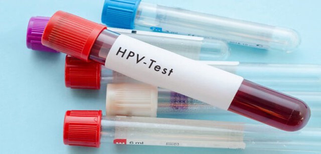 Ngoài ung thư cổ tử cung, vắc xin HPV giúp phòng các bệnh ung thư nào nữa? - Ảnh 1.