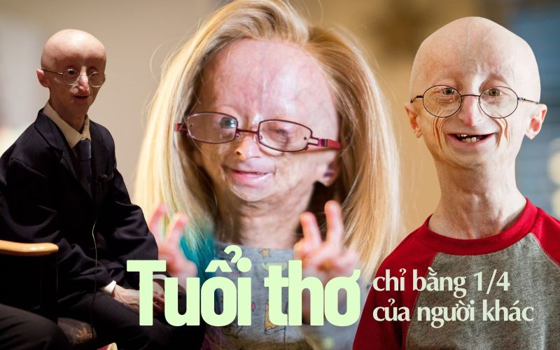 Những đứa trẻ có &quot;tuổi thơ bị rút ngắn&quot; và câu chuyện lão hóa ngay khi còn là trẻ con