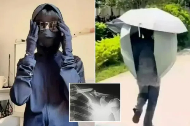 1 phụ nữ bị gãy xương chỉ sau cú lăn người trên giường, bác sĩ nói chống nắng kiểu này mà không dùng 2 món bổ xương thì khó tránh!- Ảnh 1. 1 phụ nữ bị gãy xương chỉ sau cú lăn người trên giường, bác sĩ nói chống nắng kiểu này mà không dùng 2 món bổ xương thì khó tránh!- Ảnh 1.
