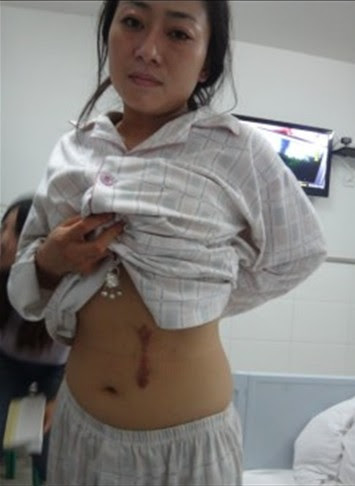 Thai phụ nhận tin 1 quả thận "mất tích" khi siêu âm: Bên giám định nghi ngờ có người can thiệp? - Ảnh 5. Thai phụ nhận tin 1 quả thận "mất tích" khi siêu âm: Bên giám định nghi ngờ có người can thiệp? - Ảnh 5.