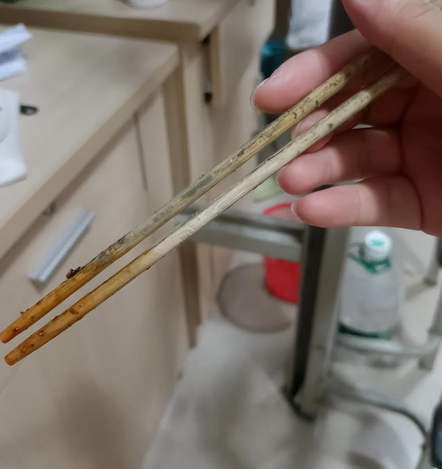 Bác sĩ đến chơi nhà, ngồi vào bàn ăn bỗng thét lên: "Sao lại dùng những đôi đũa này" - Ảnh 1. Bác sĩ đến chơi nhà, ngồi vào bàn ăn bỗng thét lên: "Sao lại dùng những đôi đũa này" - Ảnh 1.