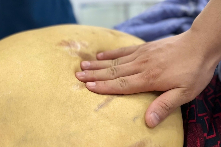 'Nát' gan, đối mặt ung thư vì thói quen nhiều người Việt vô tư làm - Ảnh 1. 'Nát' gan, đối mặt ung thư vì thói quen nhiều người Việt vô tư làm - Ảnh 1.