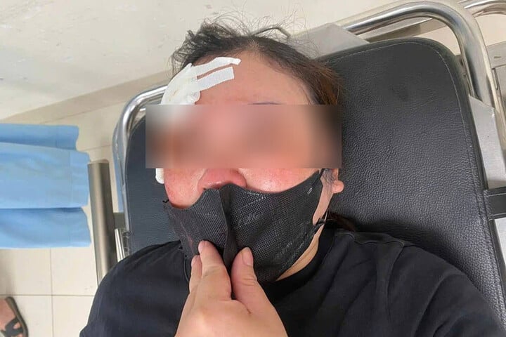 Xác minh thông tin người phụ nữ bị tài xế ô tô bán tải dùng dùi cui vụt vào đầu - Ảnh 1. Xác minh thông tin người phụ nữ bị tài xế ô tô bán tải dùng dùi cui vụt vào đầu - Ảnh 1.