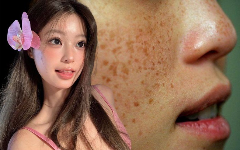 Hầu hết chị em đang bôi kem chống nắng kiểu này, bảo sao da sạm nám và nhăn nheo thấy rõ vào mùa hè