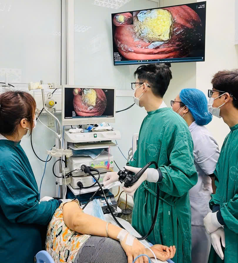 Kinh hoàng phát hiện bã thức ăn to bằng quả trứng trong dạ dày cụ bà do thói quen ăn các loại trái cây xanh - Ảnh 1. Kinh hoàng phát hiện bã thức ăn to bằng quả trứng trong dạ dày cụ bà do thói quen ăn các loại trái cây xanh - Ảnh 1.