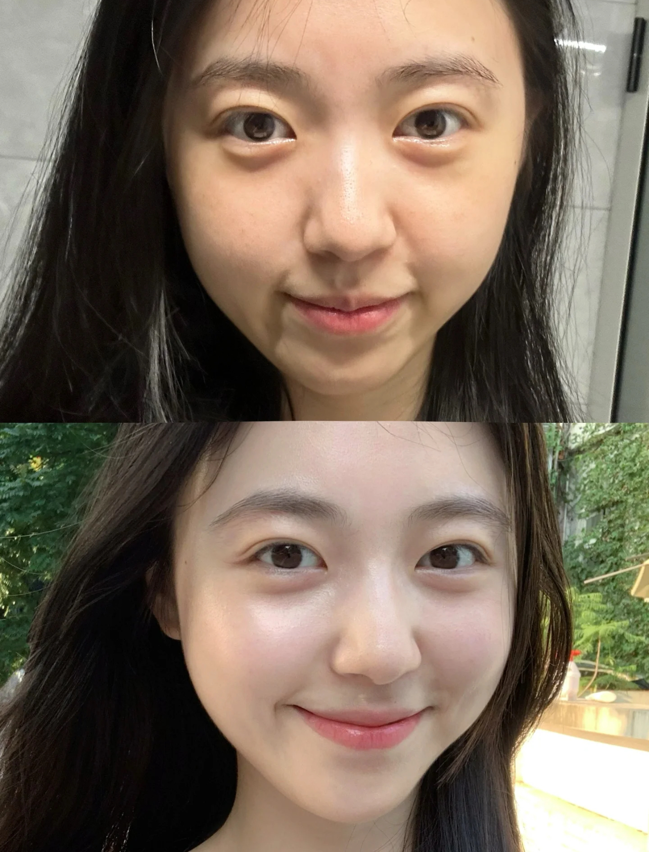 Dân tình đua nhau chà thứ hạt màu nâu lên mặt: Hóa ra là botox tự nhiên, da căng bóng khỏi sợ lão hóa- Ảnh 8. Dân tình đua nhau chà thứ hạt màu nâu lên mặt: Hóa ra là botox tự nhiên, da căng bóng khỏi sợ lão hóa- Ảnh 8.
