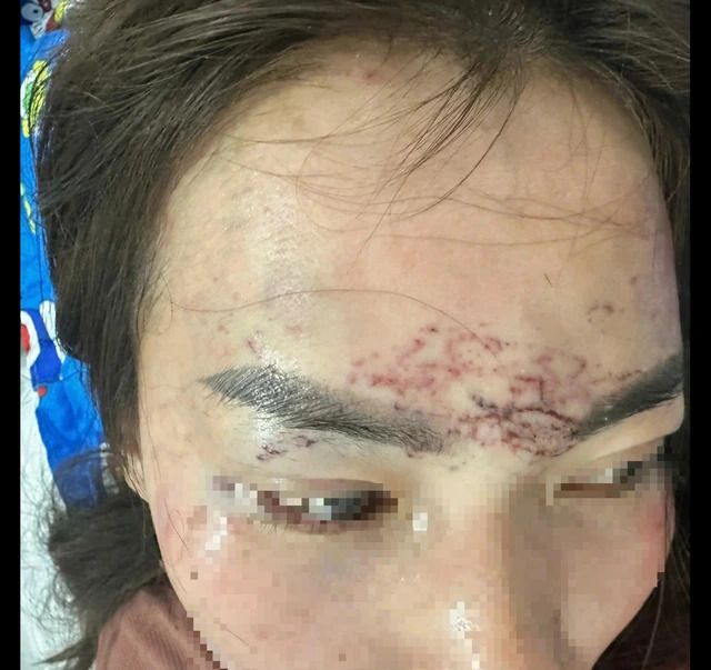 Khởi tố vụ bắt người phụ nữ đem về xăm, cắt tóc và đánh đập gây chấn động dư luận ở Cà Mau- Ảnh 1. Khởi tố vụ bắt người phụ nữ đem về xăm, cắt tóc và đánh đập gây chấn động dư luận ở Cà Mau- Ảnh 1.