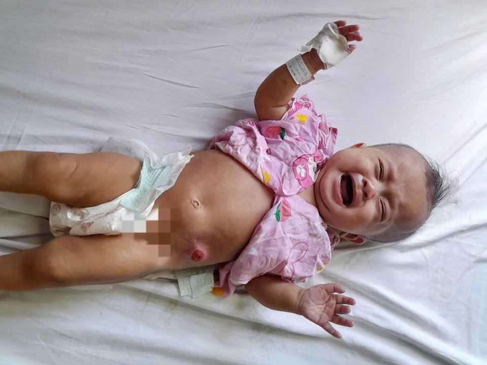 Ánh mắt cầu cứu của bé gái 6 tháng tuổi bị dị tật bẩm sinh, không tiền cứu chữa- Ảnh 4. Ánh mắt cầu cứu của bé gái 6 tháng tuổi bị dị tật bẩm sinh, không tiền cứu chữa- Ảnh 4.