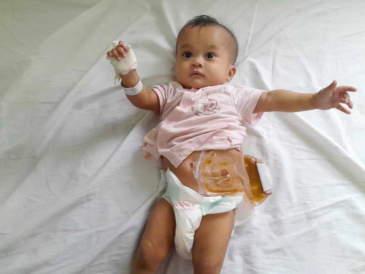 Ánh mắt cầu cứu của bé gái 6 tháng tuổi bị dị tật bẩm sinh, không tiền cứu chữa- Ảnh 2. Ánh mắt cầu cứu của bé gái 6 tháng tuổi bị dị tật bẩm sinh, không tiền cứu chữa- Ảnh 2.