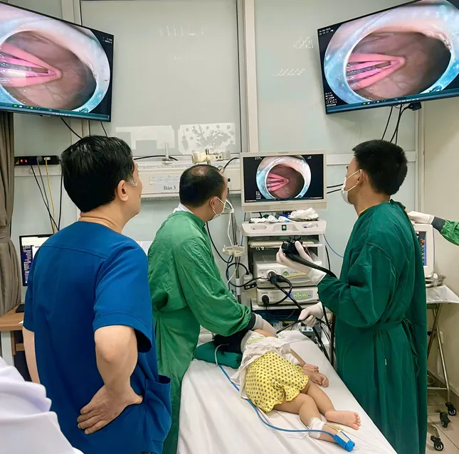 Bé 21 tháng tuổi nuốt kẹp tóc vào bụng, lời cảnh báo với các phụ huynh - Ảnh 1. Bé 21 tháng tuổi nuốt kẹp tóc vào bụng, lời cảnh báo với các phụ huynh - Ảnh 1.