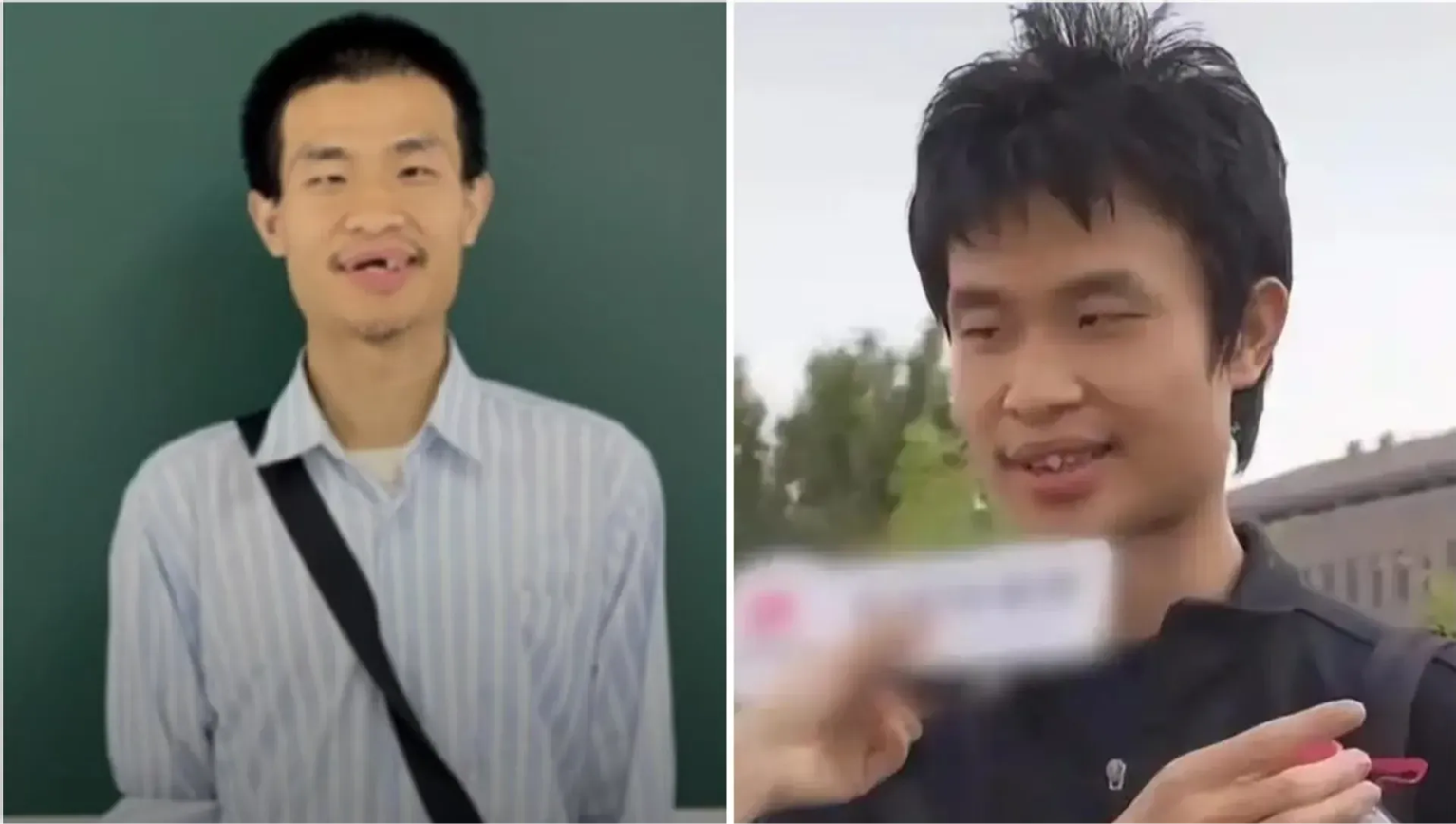 &quot;Thiên tài toán học&quot; Trung Quốc xuất hiện với ngoại hình khác lạ!- Ảnh 1.
