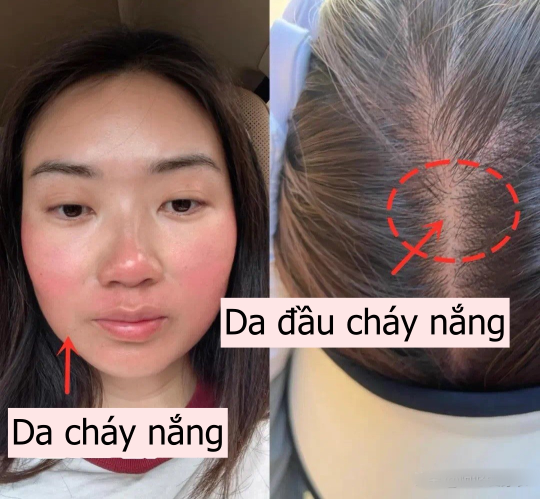 Lời khuyên cho phụ nữ trung niên: 3 kiểu mũ "dù có cho cũng đừng đội" vì vừa rẻ tiền vừa không chống nắng! - Ảnh 8. Lời khuyên cho phụ nữ trung niên: 3 kiểu mũ "dù có cho cũng đừng đội" vì vừa rẻ tiền vừa không chống nắng! - Ảnh 8.