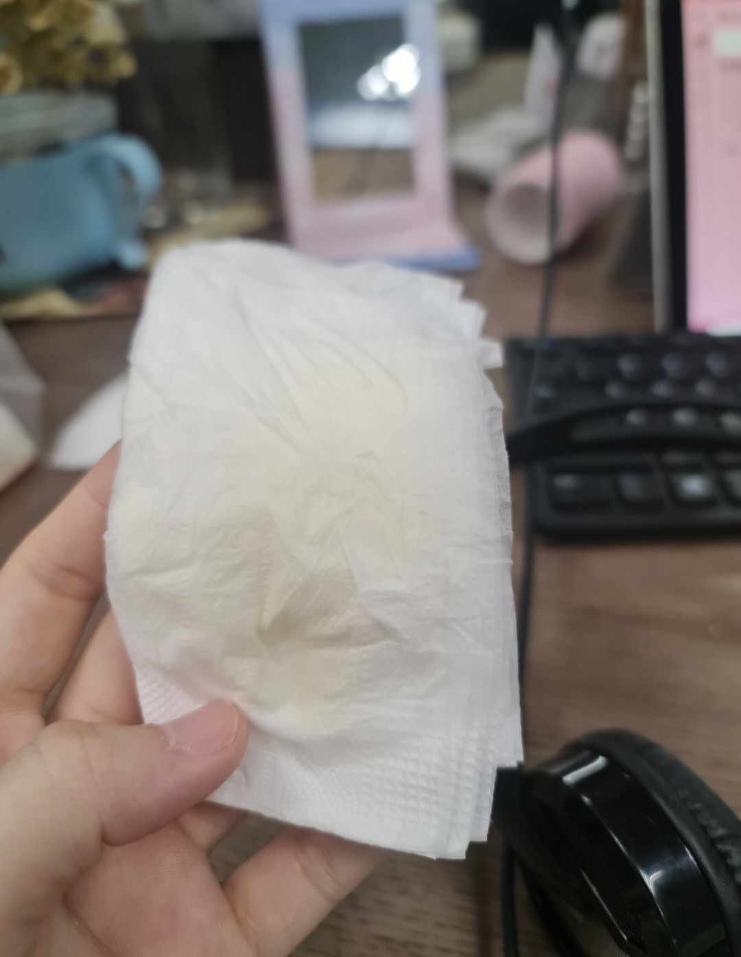 Những bức ảnh phát ra tiếng khóc thét: Nỗi ám ảnh mang tên TẮC TIA SỮA, ngoài sữa ra các mẹ còn có thể sản xuất được cả... phomai- Ảnh 1. Những bức ảnh phát ra tiếng khóc thét: Nỗi ám ảnh mang tên TẮC TIA SỮA, ngoài sữa ra các mẹ còn có thể sản xuất được cả... phomai- Ảnh 1.