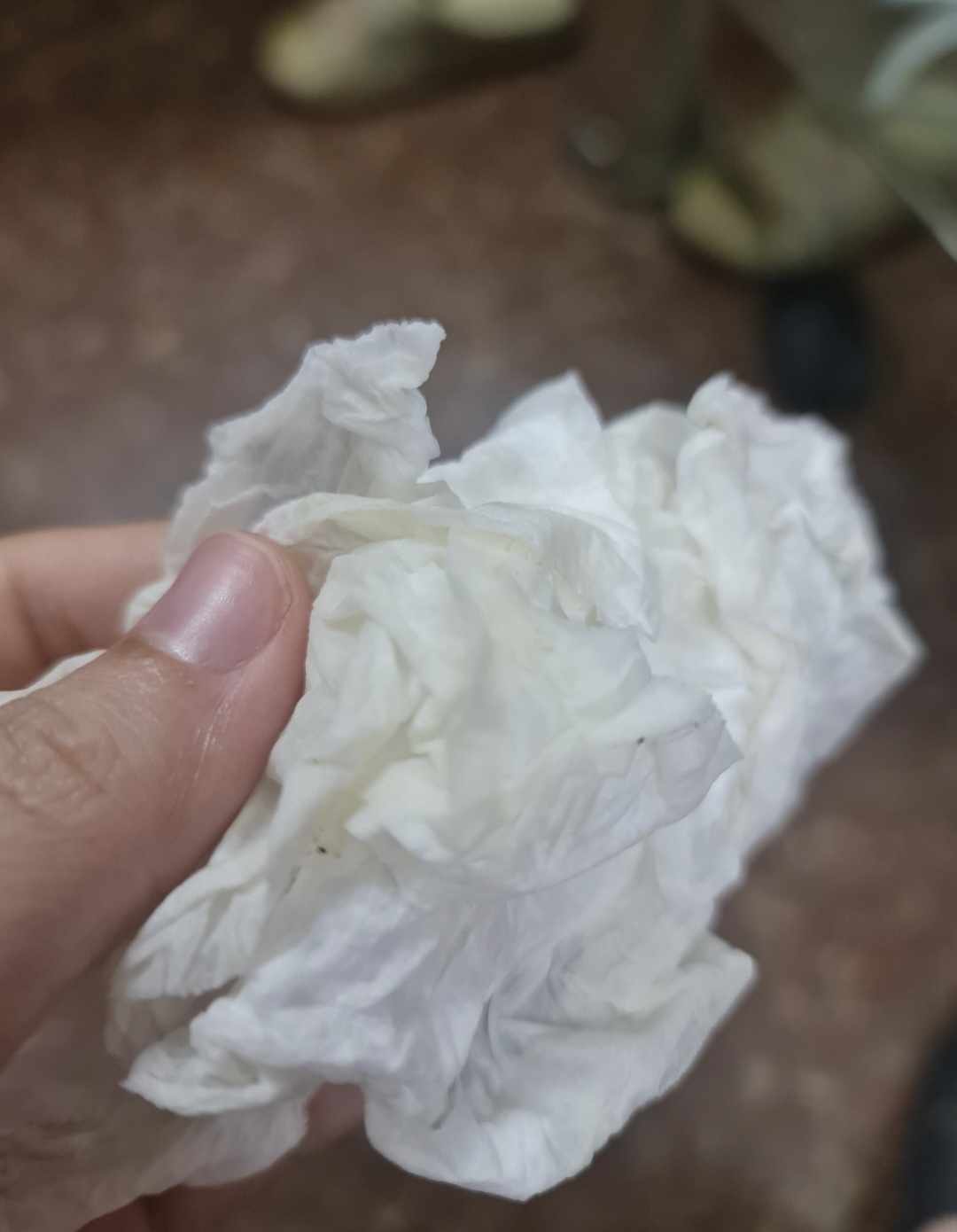 Những bức ảnh phát ra tiếng khóc thét: Nỗi ám ảnh mang tên TẮC TIA SỮA, ngoài sữa ra các mẹ còn có thể sản xuất được cả... phomai- Ảnh 2. Những bức ảnh phát ra tiếng khóc thét: Nỗi ám ảnh mang tên TẮC TIA SỮA, ngoài sữa ra các mẹ còn có thể sản xuất được cả... phomai- Ảnh 2.