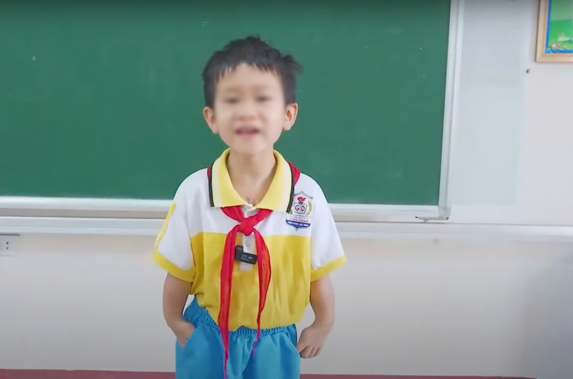 Hành trình tìm lại đôi tay lành lặn cho cậu bé mê hát dân ca- Ảnh 2. Hành trình tìm lại đôi tay lành lặn cho cậu bé mê hát dân ca- Ảnh 2.