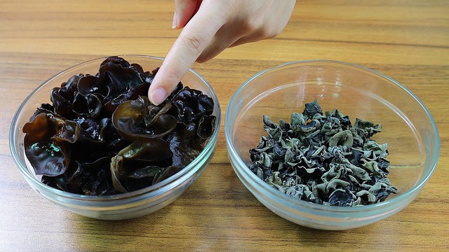 Chỉ vì 1 đĩa đồ ăn trong tủ lạnh, người phụ nữ bị suy gan cấp, phải “thay máu” cứu mạng - Ảnh 3. Chỉ vì 1 đĩa đồ ăn trong tủ lạnh, người phụ nữ bị suy gan cấp, phải “thay máu” cứu mạng - Ảnh 3.
