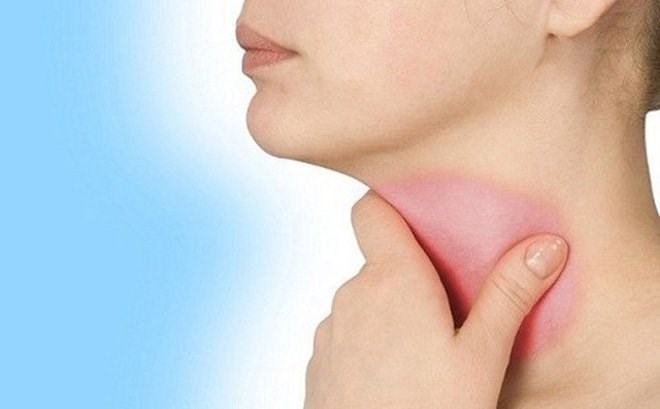 Thói quen ăn uống tưởng chừng vô hại âm thầm phá hủy tế bào, gia tăng nguy cơ ung thư thực quản- Ảnh 3.