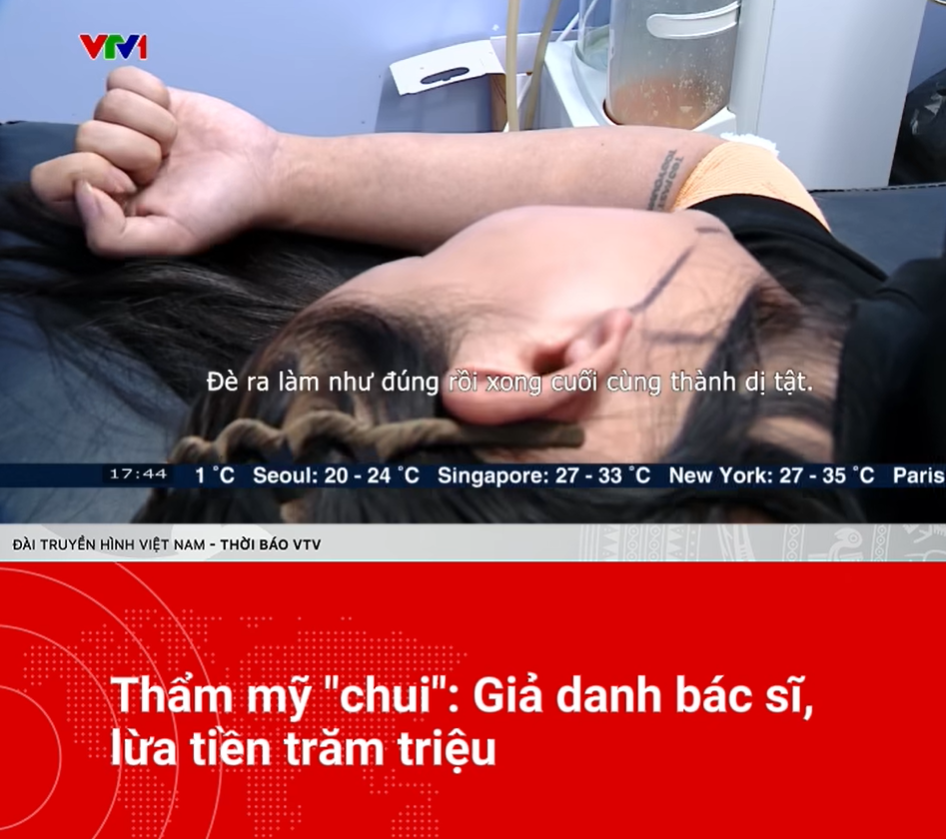 hut-mo-noi-soi3-1750851061988267626423.png