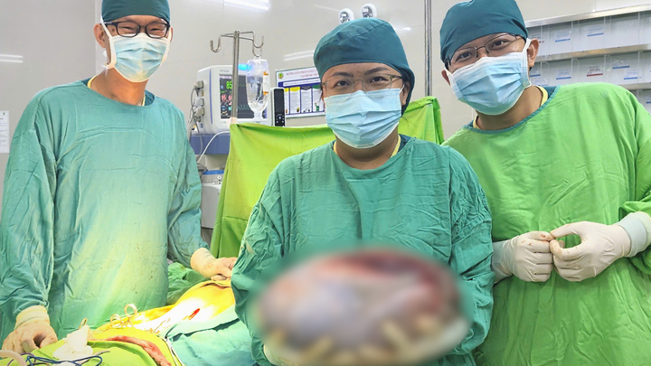 Bé gái 13 tuổi có khối u buồng trứng gần 8 kg - Ảnh 1.