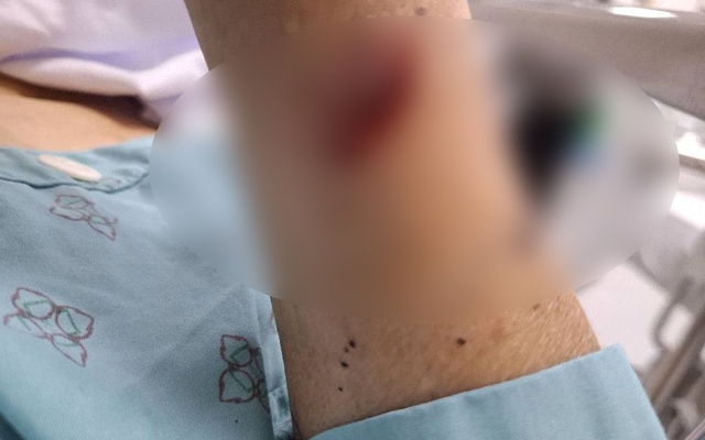 2 phụ nữ chém nhau bị thương nặng vì ghen tuông ở Thái Bình: Hé lộ tình trạng hôn nhân phức tạp