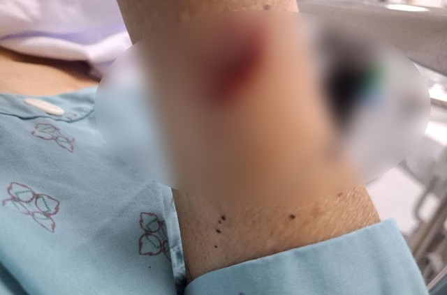 2 phụ nữ chém nhau bị thương nặng vì ghen tuông ở Thái Bình: Hé lộ tình trạng hôn nhân phức tạp - Ảnh 1. 2 phụ nữ chém nhau bị thương nặng vì ghen tuông ở Thái Bình: Hé lộ tình trạng hôn nhân phức tạp - Ảnh 1.