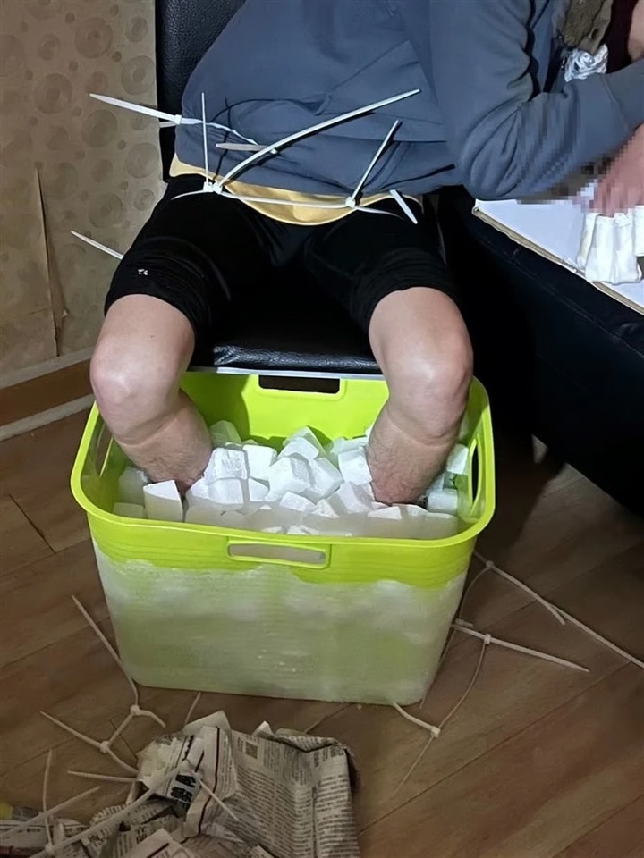 Ngâm chân trong đá để đòi tiền bảo hiểm, thanh niên vừa cụt chân vừa phải đi tù - Ảnh 1. Ngâm chân trong đá để đòi tiền bảo hiểm, thanh niên vừa cụt chân vừa phải đi tù - Ảnh 1.