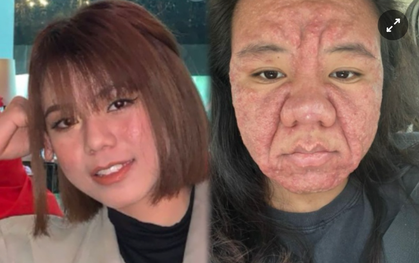 Gương mặt thay đổi khó tin vì mang thai: Hành trình làm mẹ của cô gái 28 tuổi khiến nhiều người xót xa- Ảnh 1. Gương mặt thay đổi khó tin vì mang thai: Hành trình làm mẹ của cô gái 28 tuổi khiến nhiều người xót xa- Ảnh 1.