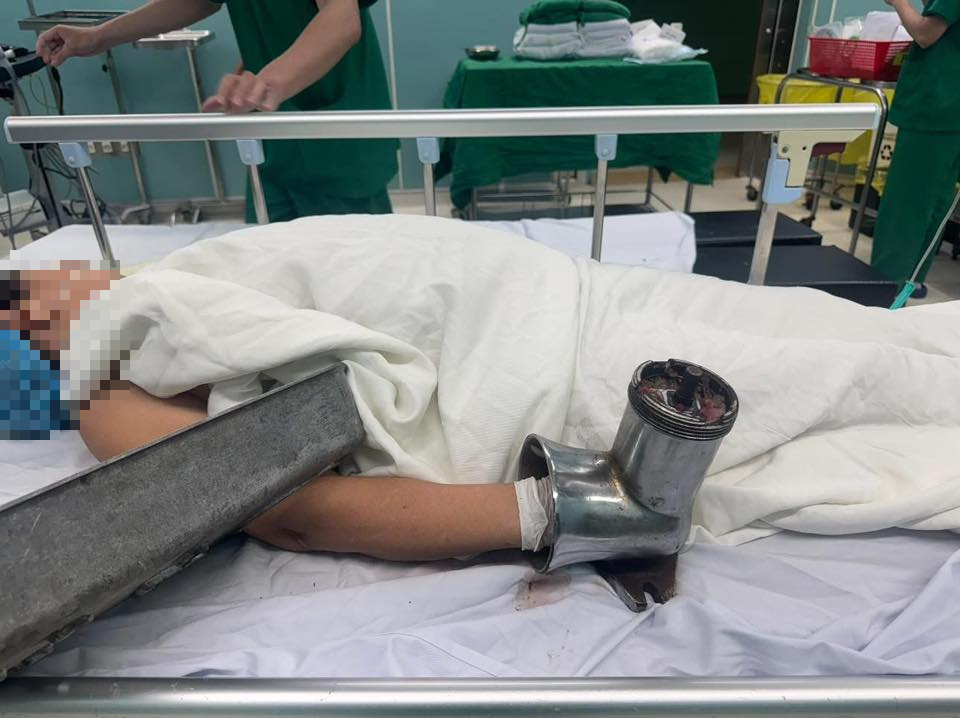 Người phụ nữ b&aacute;n thịt bị cuốn cả b&agrave;n tay v&agrave;o m&aacute;y xay thịt - Ảnh 1.