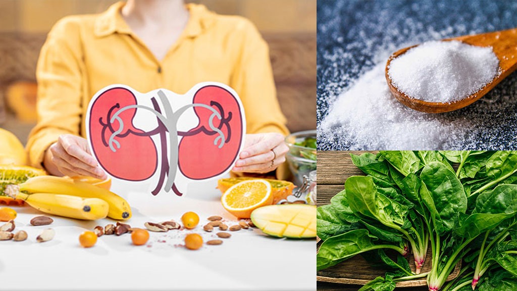 Ăn rau tốt cho sức khỏe nhưng có 4 loại rau ăn nhiều dễ bị sỏi thận, suy thận, loại thứ chợ Việt cũng có- Ảnh 1.
