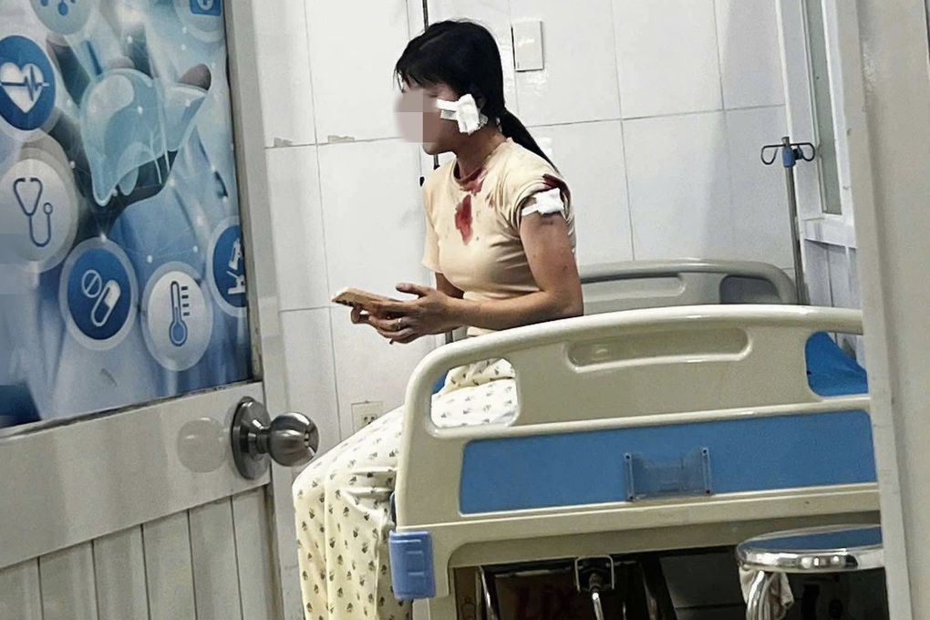 Vụ gã đàn ông túm tóc, đấm liên tiếp vào mặt vợ cũ ở Bình Dương: Người phụ nữ sinh năm 1999 lên tiếng hé lộ nguồn cơn - Ảnh 2. Vụ gã đàn ông túm tóc, đấm liên tiếp vào mặt vợ cũ ở Bình Dương: Người phụ nữ sinh năm 1999 lên tiếng hé lộ nguồn cơn - Ảnh 2.