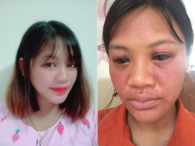 Chia sẻ về lý do được chỉ định sinh mổ, mẹ bỉm khiến dân tình thắc mắc: Bị cận nặng có được sinh thường hay không?- Ảnh 2. Chia sẻ về lý do được chỉ định sinh mổ, mẹ bỉm khiến dân tình thắc mắc: Bị cận nặng có được sinh thường hay không?- Ảnh 2.
