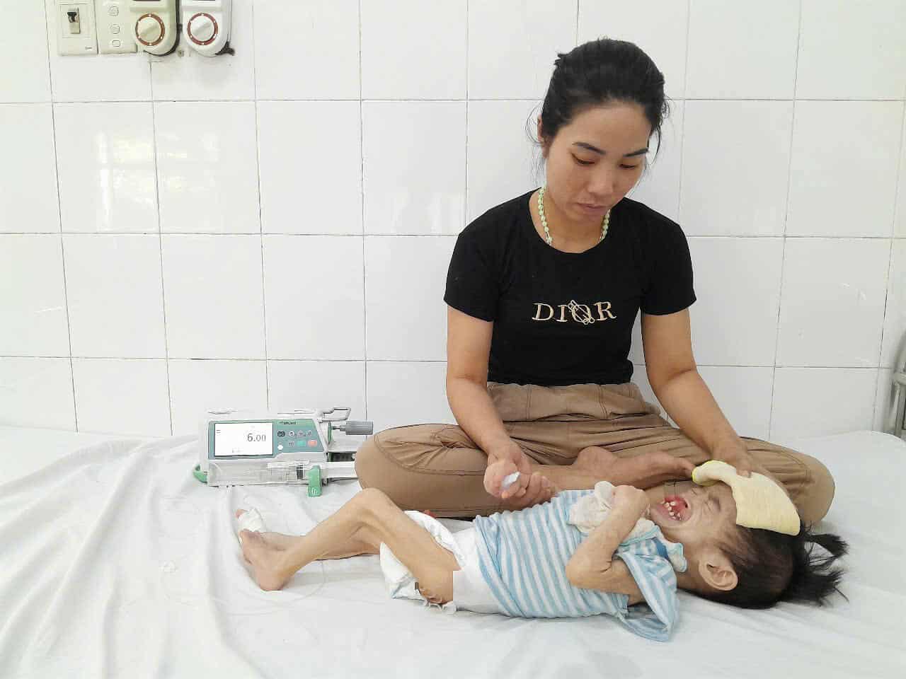 Bé gái 3 tuổi có khuôn mặt biến dạng vì dị tật mong chờ cơ hội được phẫu thuật- Ảnh 3. Bé gái 3 tuổi có khuôn mặt biến dạng vì dị tật mong chờ cơ hội được phẫu thuật- Ảnh 3.