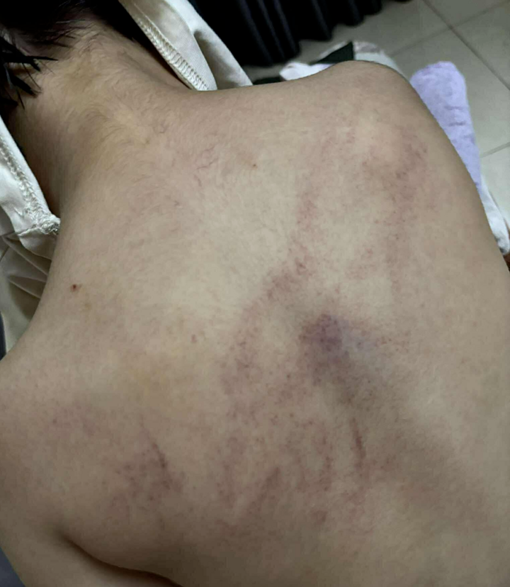 'Giáo viên hay kẻ ác nhân mà đánh trẻ không biết ghê tay' - Ảnh 1. 'Giáo viên hay kẻ ác nhân mà đánh trẻ không biết ghê tay' - Ảnh 1.