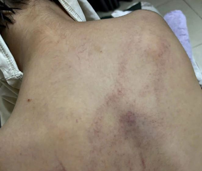 Đọc vụ bạo hành mới đây, tôi càng quyết tâm chọn trường có camera: Bảo vệ trẻ em quan trọng hơn sự riêng tư của người lớn! - Ảnh 1. Đọc vụ bạo hành mới đây, tôi càng quyết tâm chọn trường có camera: Bảo vệ trẻ em quan trọng hơn sự riêng tư của người lớn! - Ảnh 1.
