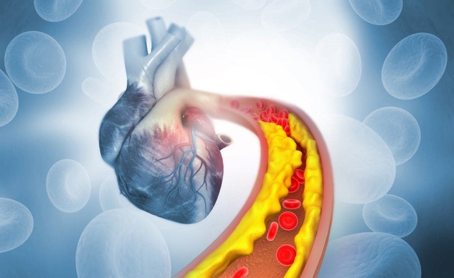 Thực phẩm có cholesterol cao gấp 3 lần mỡ lợn, cực hại nếu ăn nhiều: Người Việt rất hay ăn - Ảnh 1. Thực phẩm có cholesterol cao gấp 3 lần mỡ lợn, cực hại nếu ăn nhiều: Người Việt rất hay ăn - Ảnh 1.