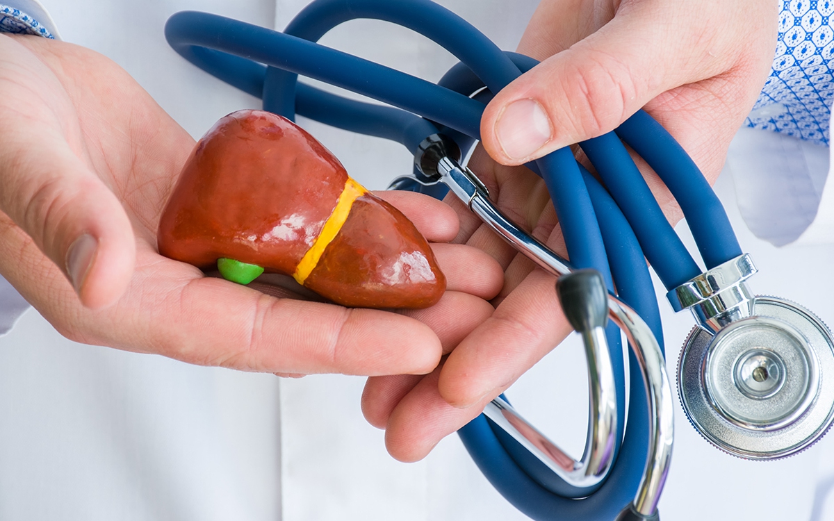 fatty-liver-disease-feat-1663232747964138802659-30-0-780-1200-crop-16632327621412029085789-1752536694337-17525366944461267527966.jpg