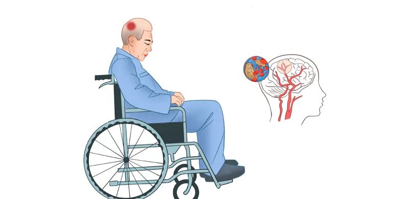 Sau 9h tối, tốt nhất đừng làm 3 việc này: Cơ thể sẽ cảm ơn bạn vì được ngủ ngon lại tránh đột quỵ- Ảnh 1. Sau 9h tối, tốt nhất đừng làm 3 việc này: Cơ thể sẽ cảm ơn bạn vì được ngủ ngon lại tránh đột quỵ- Ảnh 1.