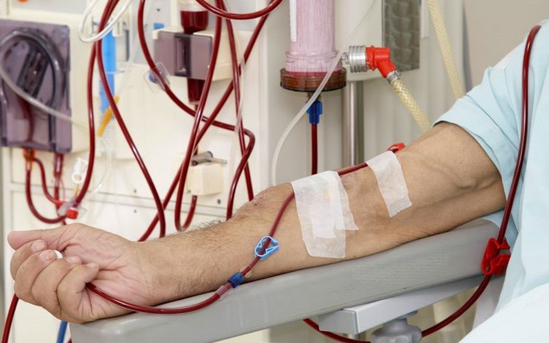 Thận kiệt quệ sau khi ăn chuối: Bác sĩ cảnh báo “kiểu ăn này cực hại”