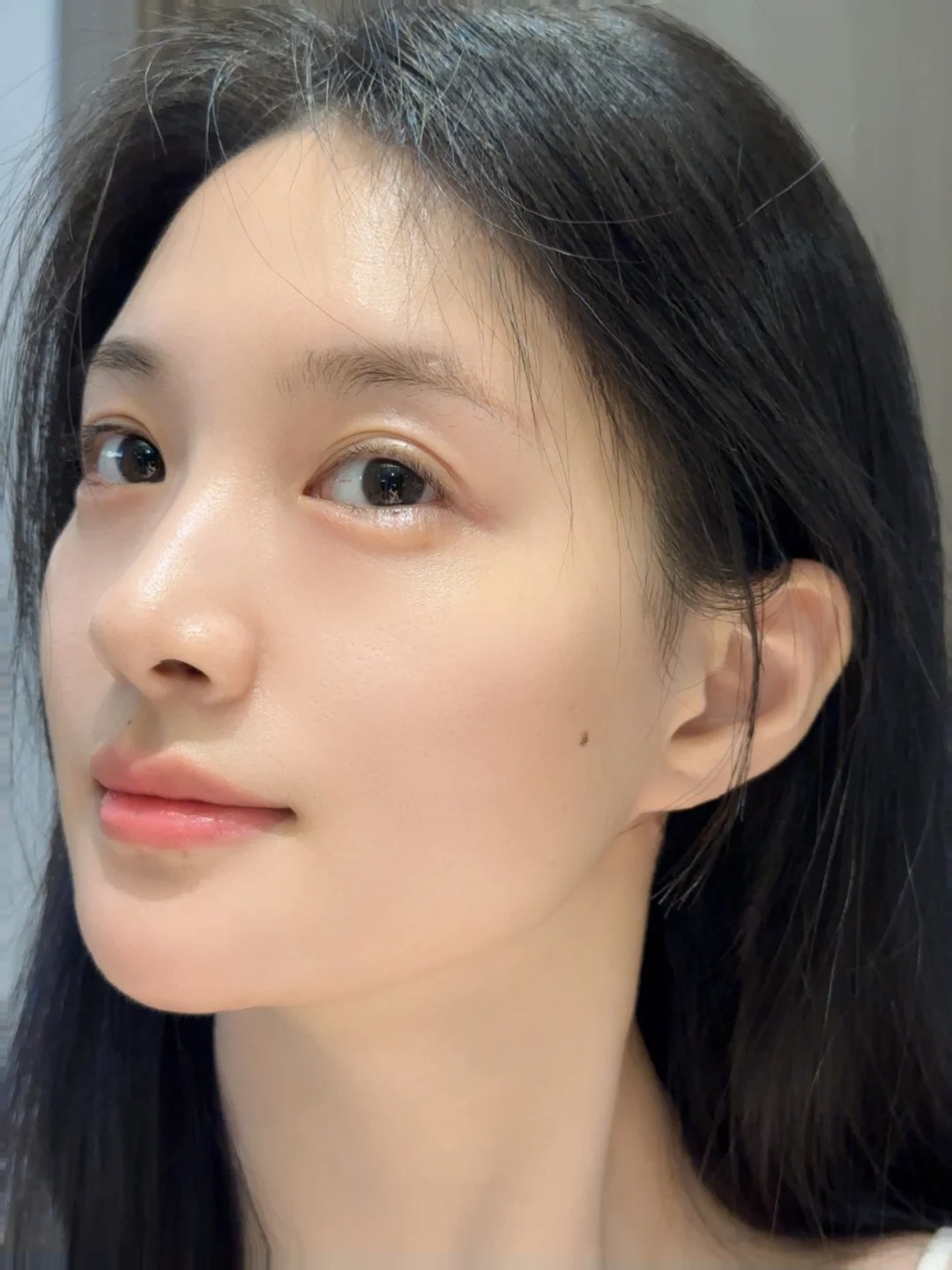 Phẫu thuật hàm mặt: Giải pháp chỉnh hình toàn diện từ cấu trúc xương - Ảnh 2. Phẫu thuật hàm mặt: Giải pháp chỉnh hình toàn diện từ cấu trúc xương - Ảnh 2.