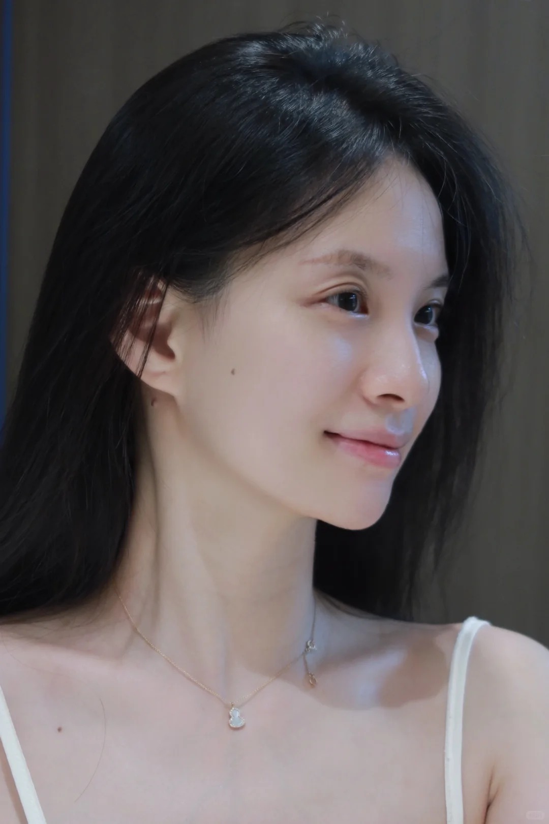 Phẫu thuật hàm mặt: Giải pháp chỉnh hình toàn diện từ cấu trúc xương - Ảnh 7. Phẫu thuật hàm mặt: Giải pháp chỉnh hình toàn diện từ cấu trúc xương - Ảnh 7.