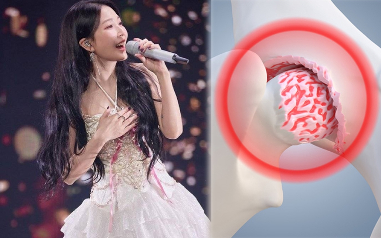 Nữ hoàng nhạc pop BoA phải hủy concert vì mắc bệnh hoại tử xương cấp tính: Hoại tử xương thường gặp ở vùng xương nào?