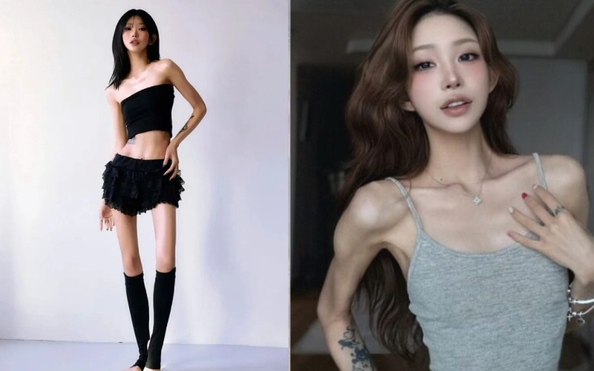 Giảm từ 96kg xuống còn 41kg nhưng con gái diễn viên Choi Jin Sil khuyên mọi người tránh xa phương pháp giảm cân này- Ảnh 2.