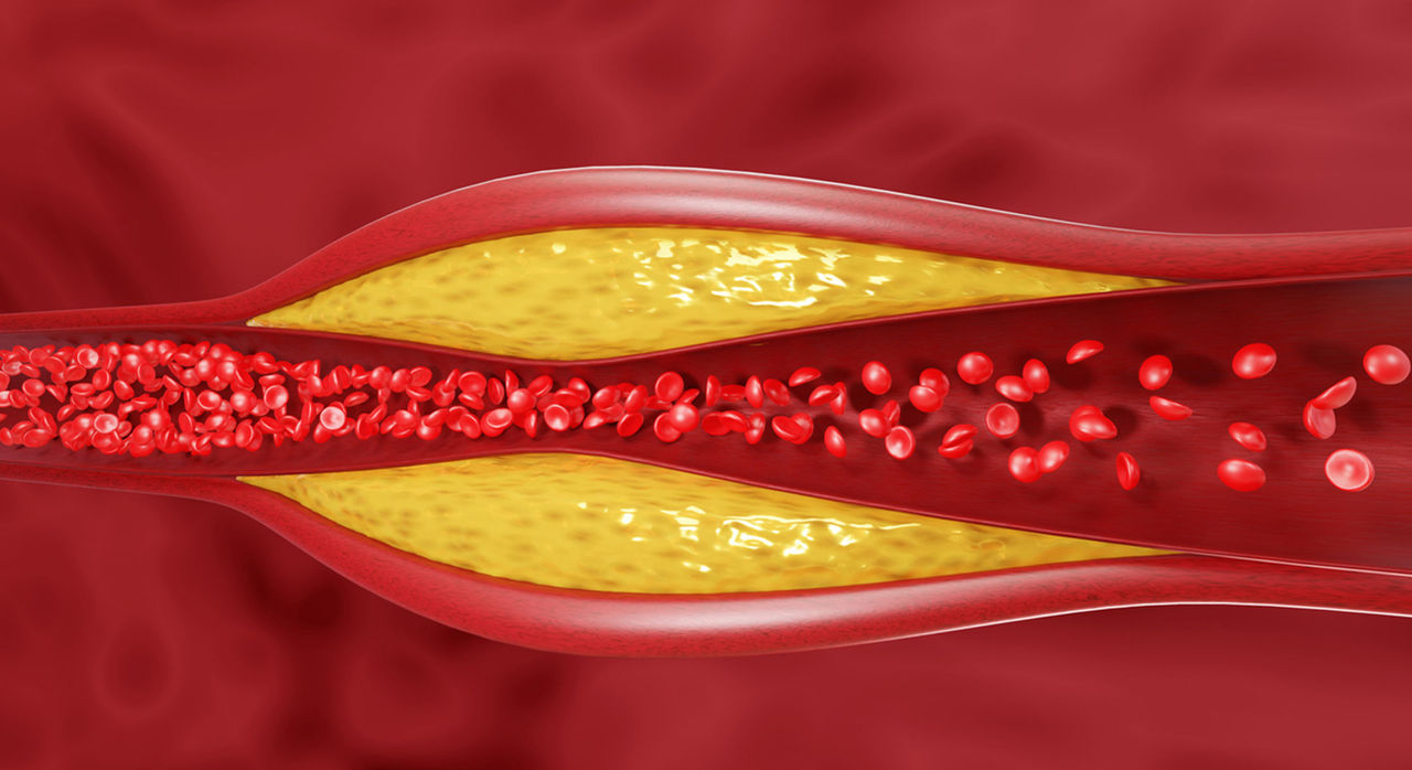 Một thực phẩm quen mặt có lượng cholesterol cao gần gấp 4 lần mỡ lợn: Ăn nhiều hại đủ đường - Ảnh 1. Một thực phẩm quen mặt có lượng cholesterol cao gần gấp 4 lần mỡ lợn: Ăn nhiều hại đủ đường - Ảnh 1.