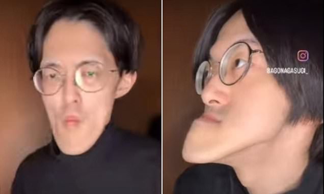 Người đàn ông có &quot;chiếc cằm dài nhất thế giới&quot;, vẫn tiếp tục dài ra- Ảnh 1.