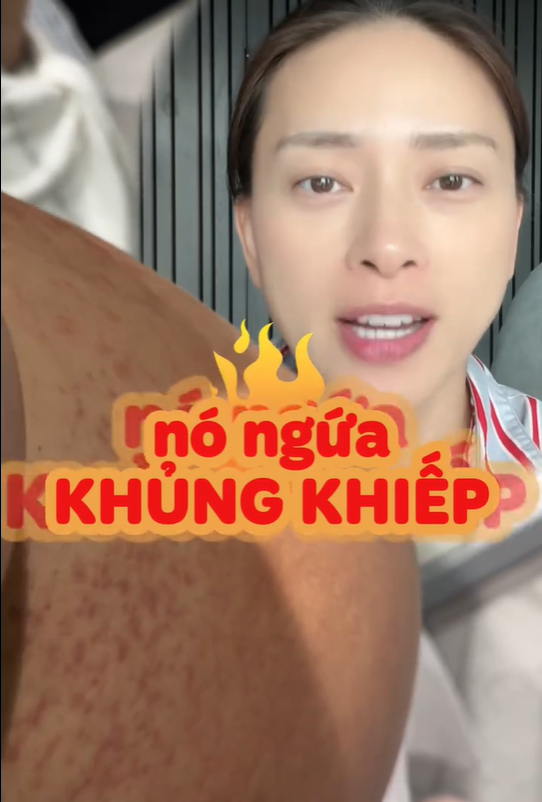 Mẹ bầu Ngô Thanh Vân gặp một tình trạng "vô cùng khó chịu" trong thai kỳ: Ngứa khủng khiếp nhưng vẫn thấy mừng vì 1 điều- Ảnh 2. Mẹ bầu Ngô Thanh Vân gặp một tình trạng "vô cùng khó chịu" trong thai kỳ: Ngứa khủng khiếp nhưng vẫn thấy mừng vì 1 điều- Ảnh 2.